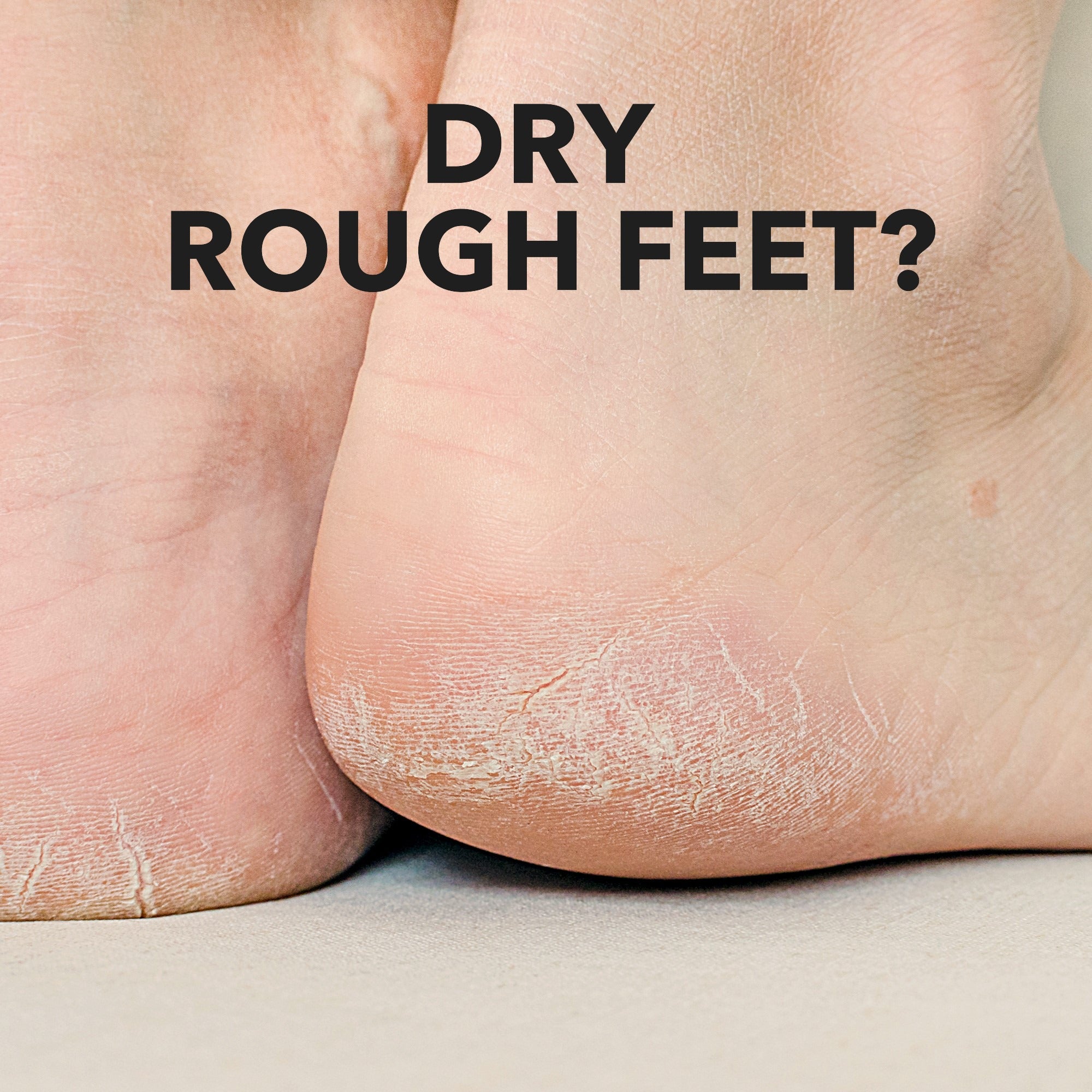 Therapeutic Repair Foot Cream