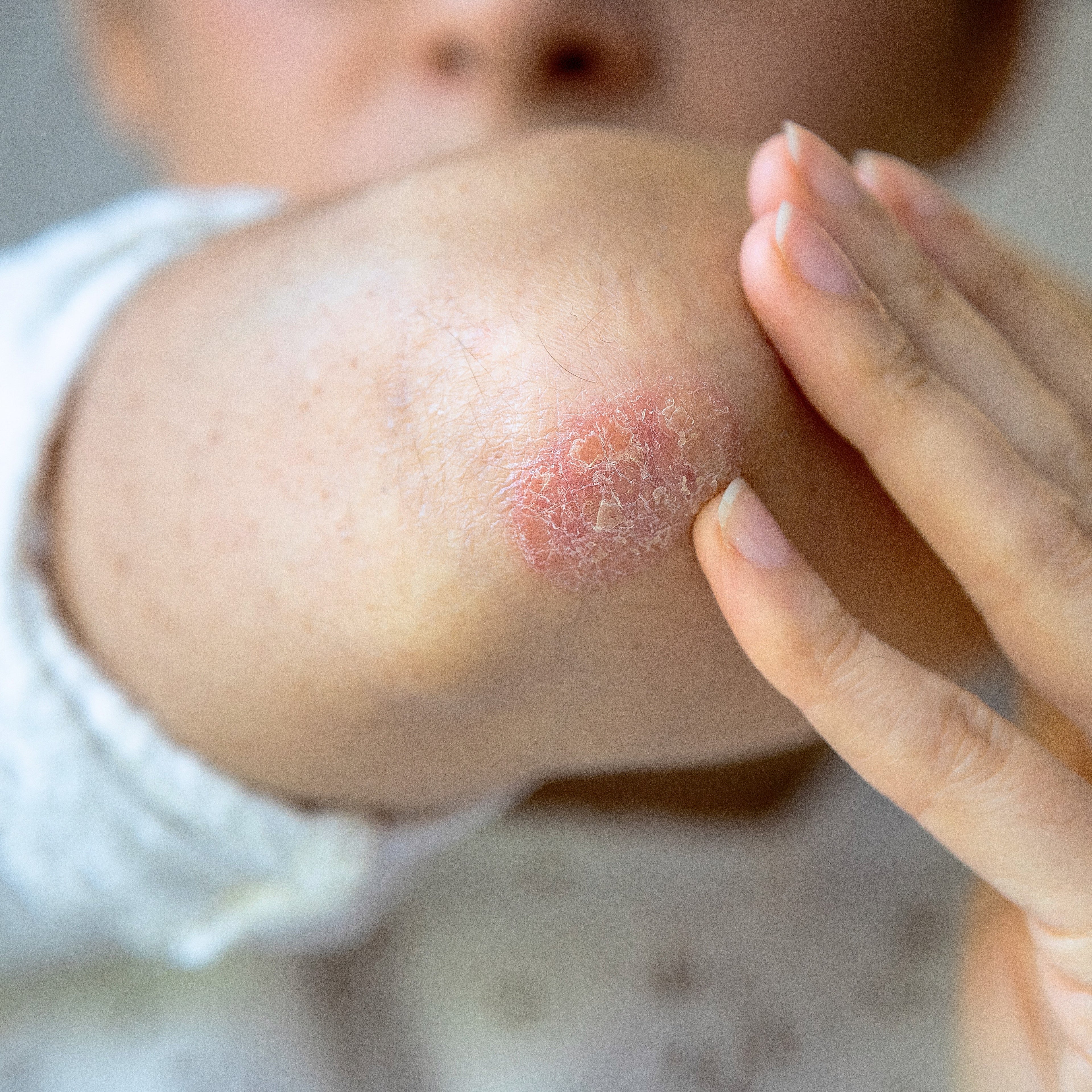 Therapeutic Repair Lotion